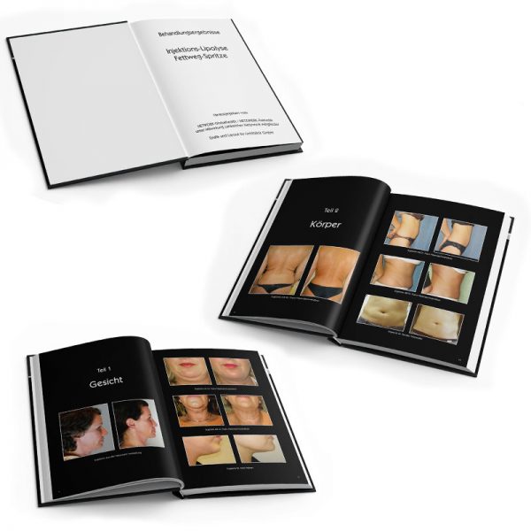 Vorher-/Nachher-Buch – Bild 2