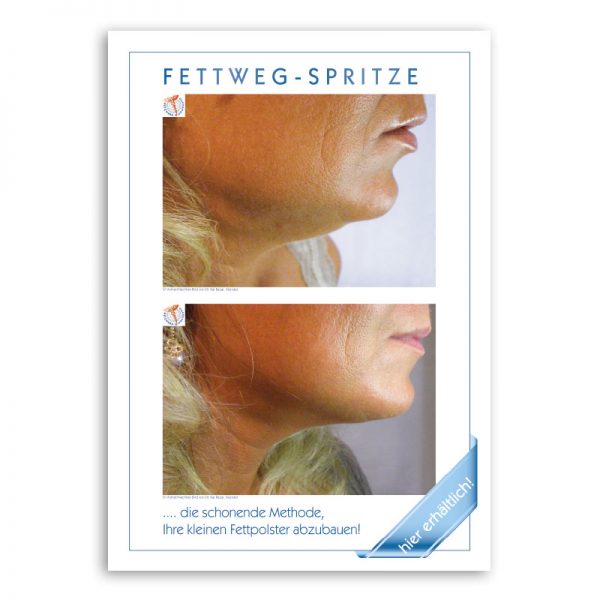 Lipolyse-Plakat mit Doppelkinn-Motiv